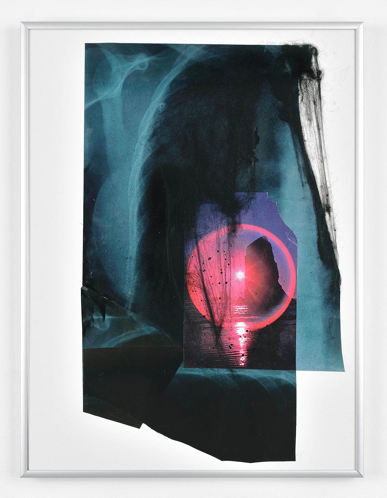 idyll -inn the abyss :: alix’s chest )
(30,5 cm x 41 cm), collage, radiograph, acrylic, tainted cotton on paper, 2015 